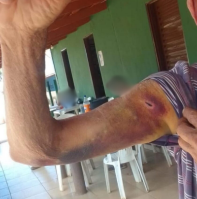 PCGO prende mulher por maus tratos e cárcere privado contra marido idoso e filho com necessidades especiais